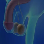 penis-egriligi